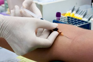Medical Malpractice can include professionals who treat patients like this one with defective drugs or procedures.