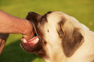 Los Angles dog bite lawyers