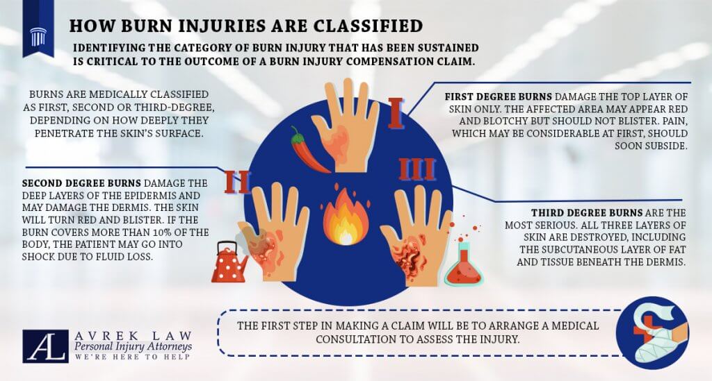 Featured image for Burns Injuries in Personal Injury Claims