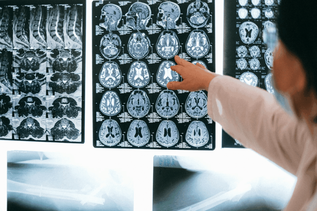 suffering-a-traumatic-brain-injury?-call-a-long-beach-car-accident-lawyer-today