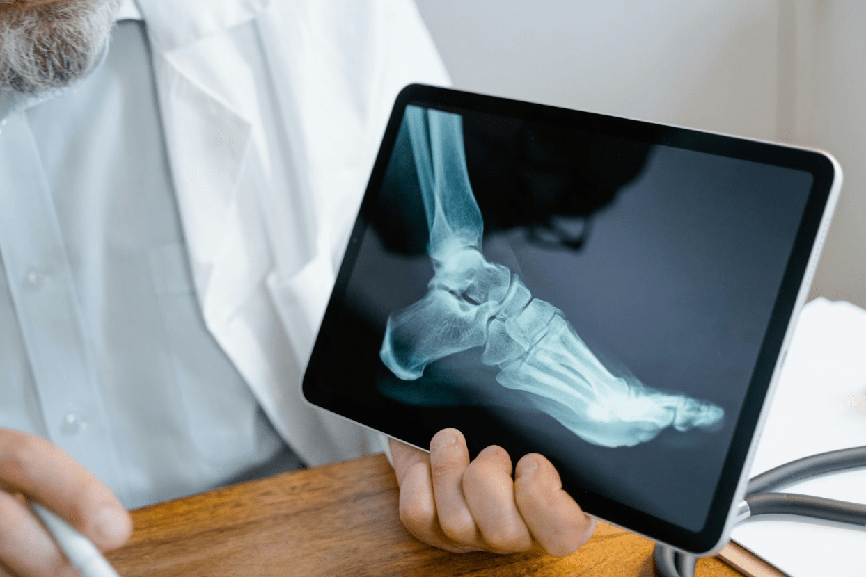 Injured-in-a-Coastal-Crash?-Trust-a-Newport-Beach-Car-Accident-Lawyer-With-Local-Insight how-a-broken-bone-can-lead-to-major-injury-claims
