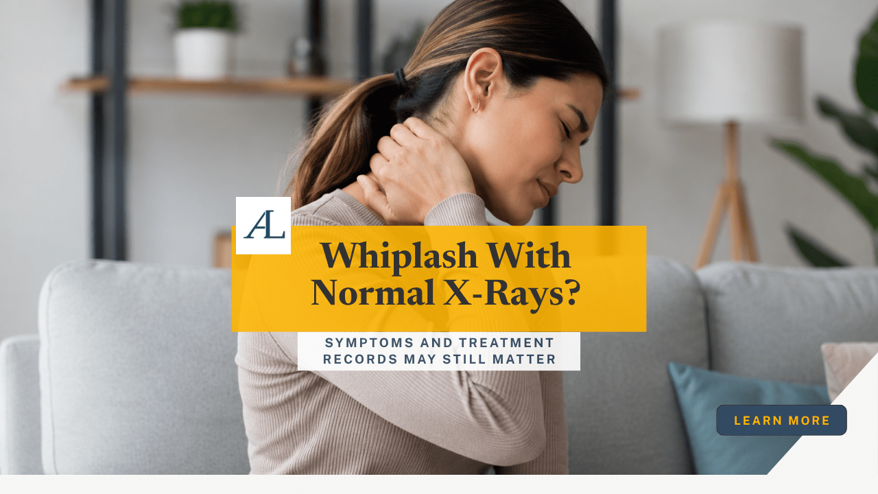 Whiplash With Normal X-Rays After a Car Accident in Huntington Beach, CA 1 whiplash with normal x rays in Huntington Beach